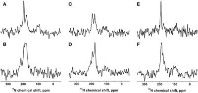 Structure, Topology, and Dynamics of Membrane-Inserted Polypeptides and Lipids by Solid-State NMR Spectroscopy: Investigations of the Transmembrane Domains of the DQ Beta-1 Subunit of the MHC II Receptor and of the COP I Protein p24